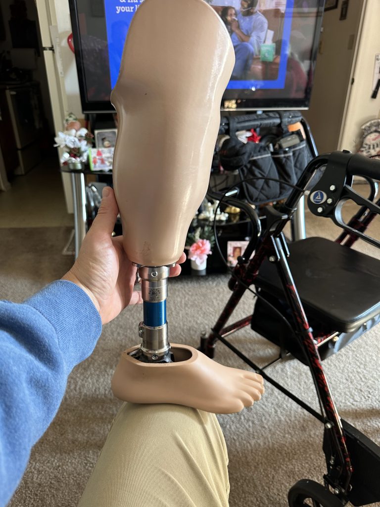 Limb Brace